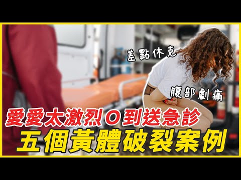 【性學小教室105】愛愛太激烈！幹到掛急診？｜五個黃體破裂案例